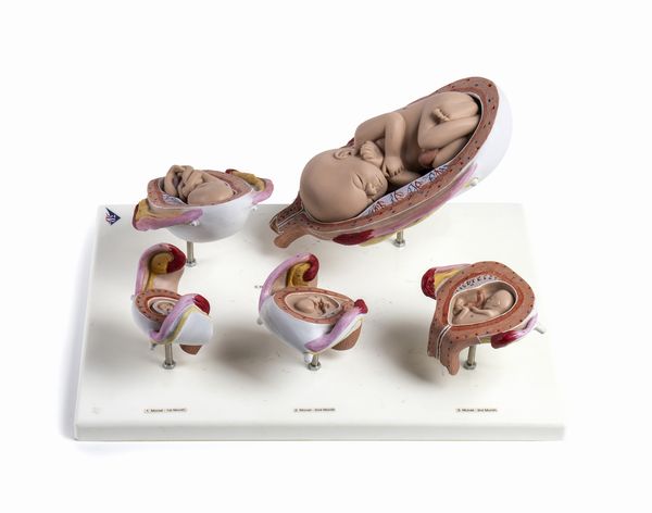 . : Modello scientifico in plastica raffigurante ciclo della crescita del feto dal primo al settimo mese. Germania, 1990.  - Asta Asta 450 | WUNDERKAMMER, CURIOSITIES & ETNOGRAFICA - A GENTLEMAN' S CABINET OF CURIOSITIES Online - Associazione Nazionale - Case d'Asta italiane