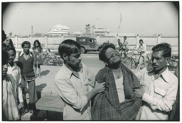 Raghu Rai : Victims suffering from eye burns, poison gas India, December 1984  - Asta Fotografia - Associazione Nazionale - Case d'Asta italiane